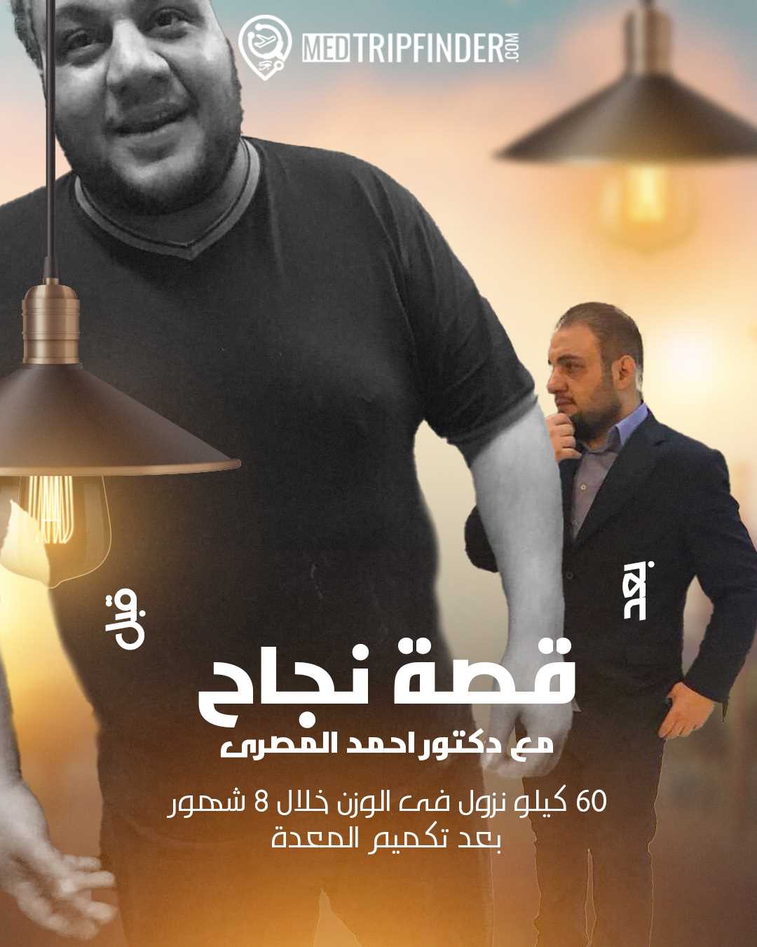 عملية تكميم المعدة في مصر عملية تكميم المعدة في مصر