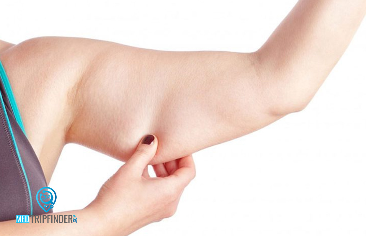 Arm-Lift