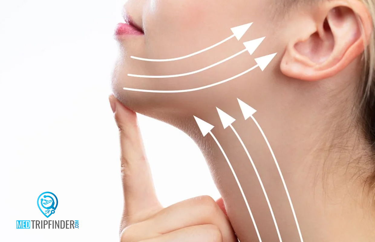 Endoscopic-Facelift-in-Egypt