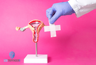 Laparoscopic-myomectomy