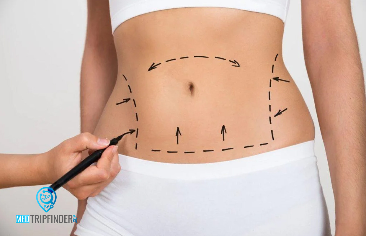 Liposuction-in-Egypt