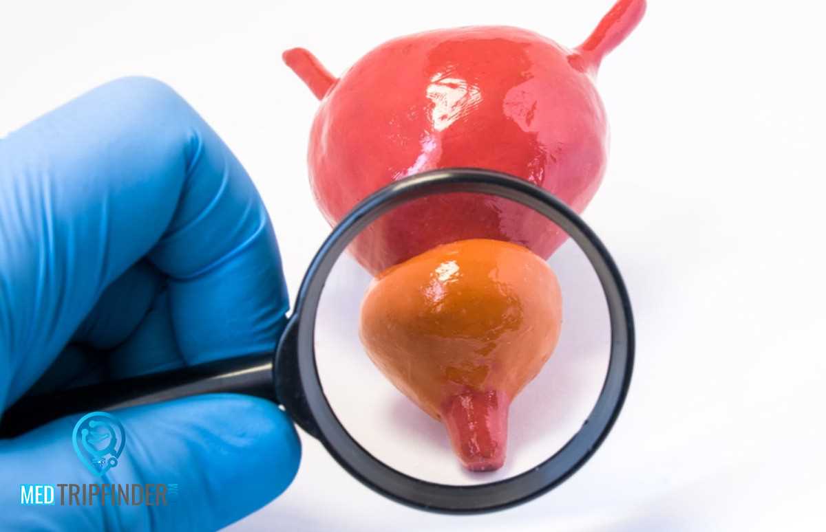 Prostatectomy