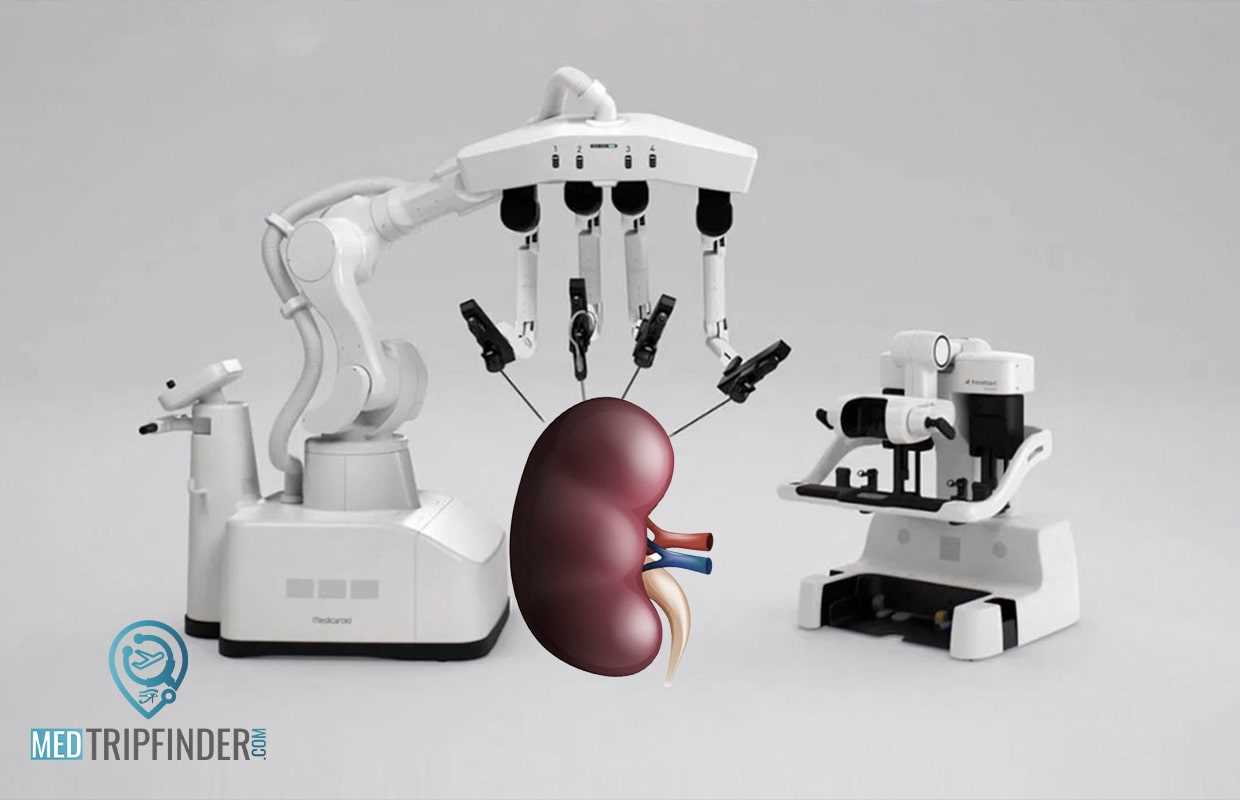 Robotic-partial-nephrectomy 
