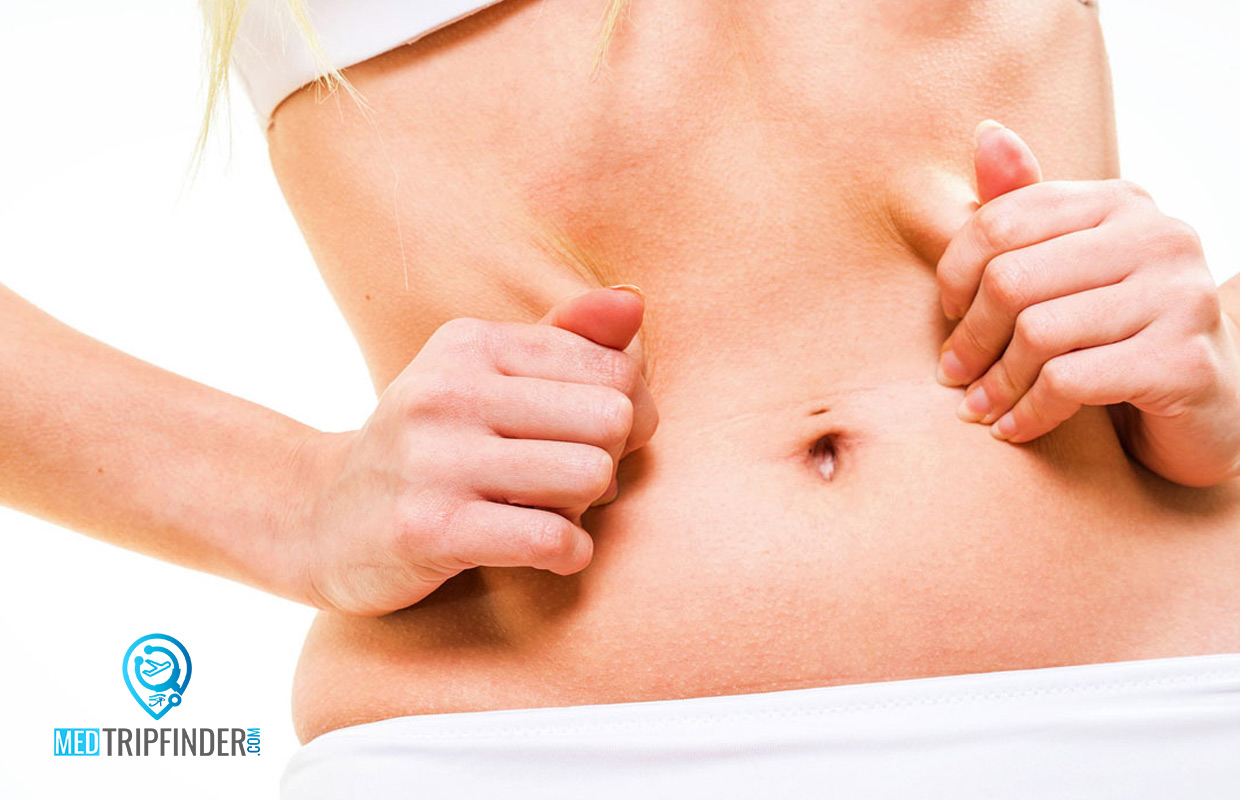 Tummy-Tuck