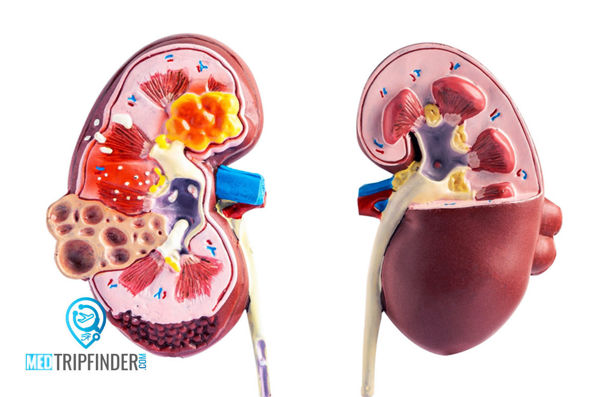 kidney-diseases