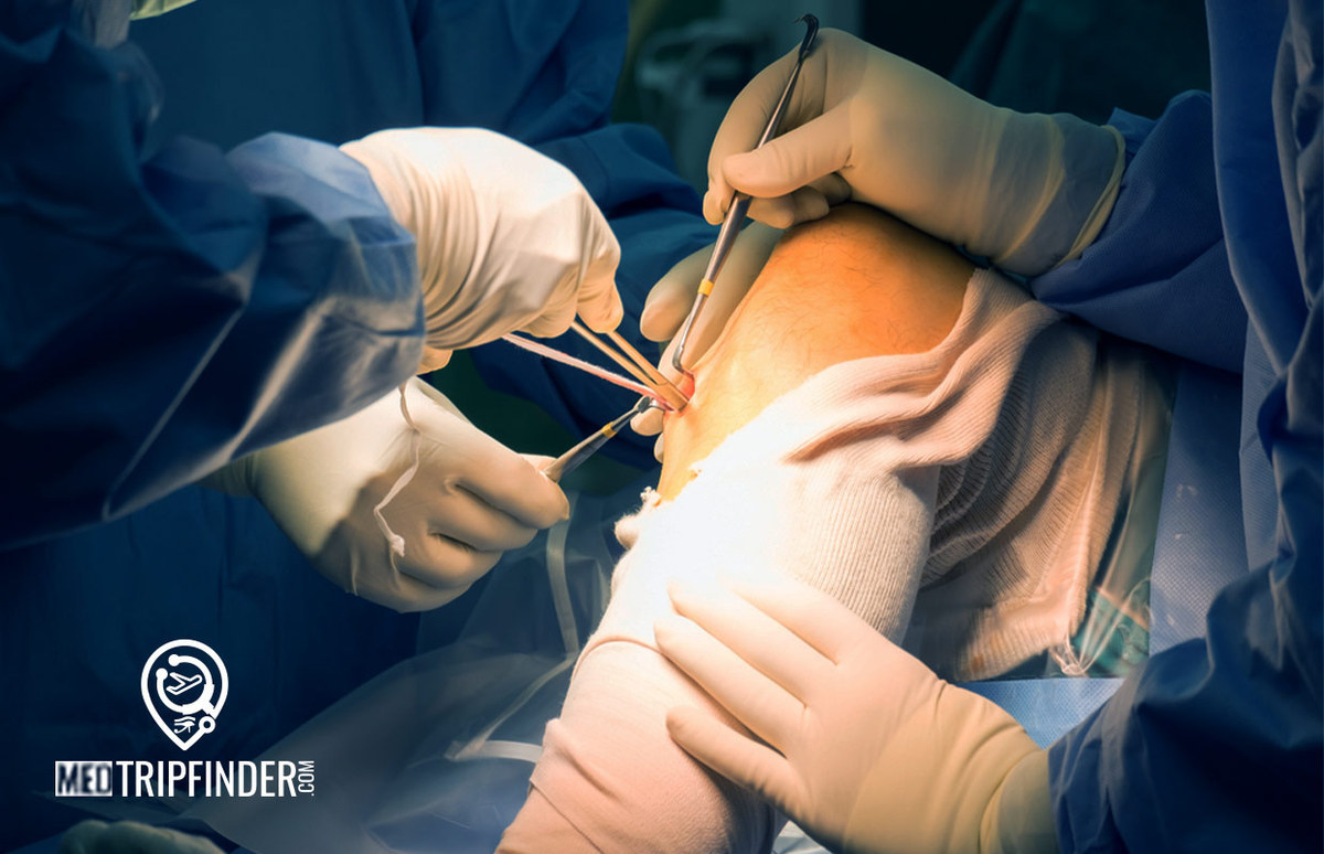 treatment-of-acl-injury