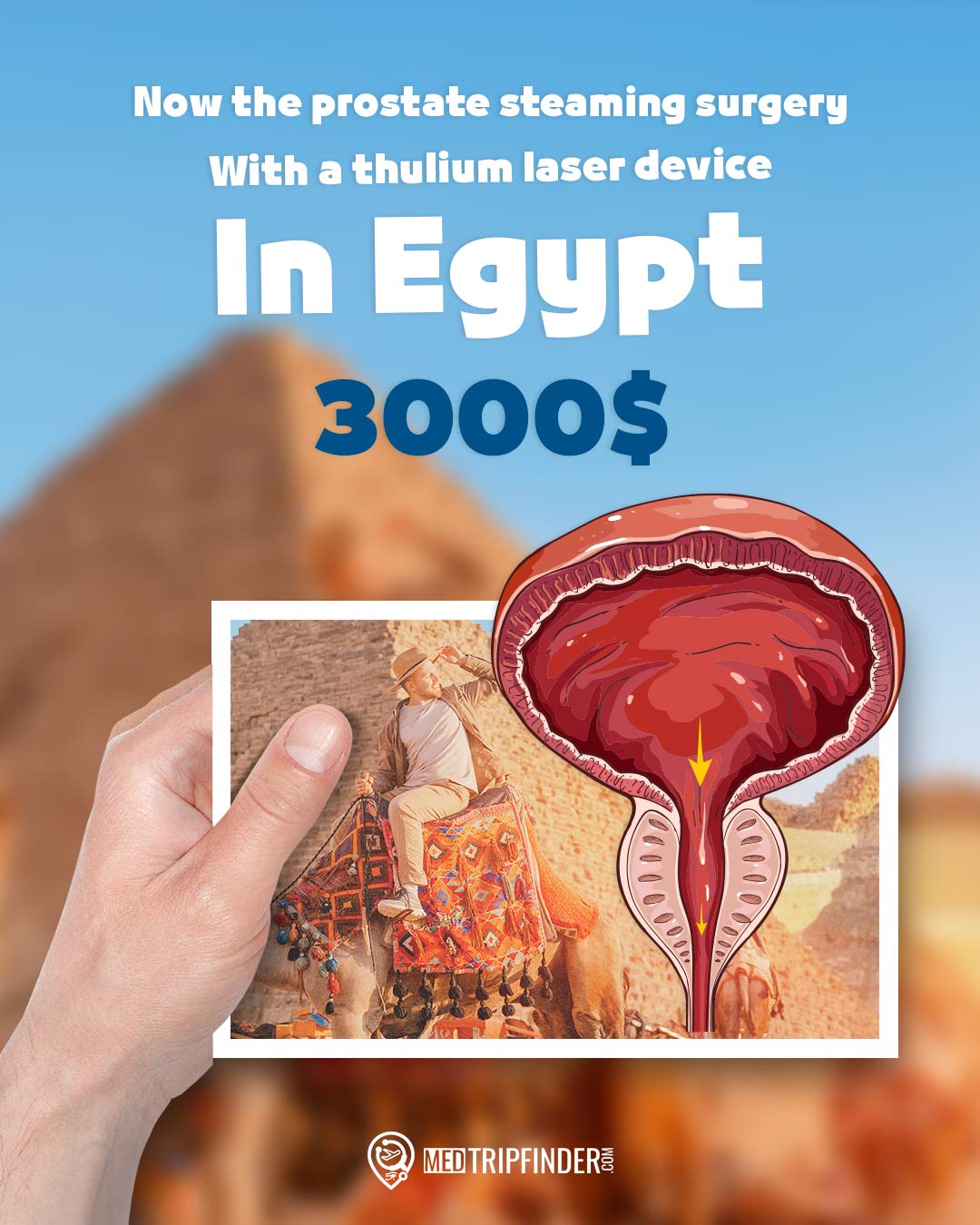 Book-Thulium-laser-vaporization-of-the-prostate-in-Egypt-with-Dr-Khaled-Habib 
