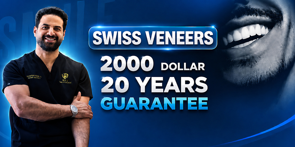Swiss-Veneers