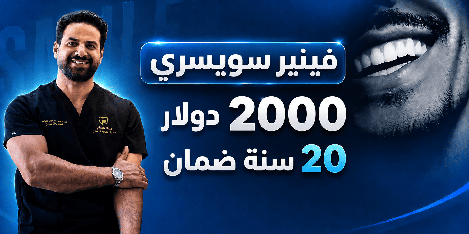 الفينير-السويسري-