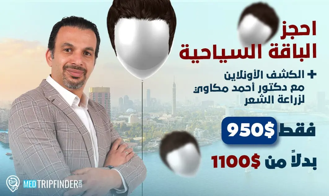 عملية-زراعة-الشعر-في-مصر-كشف-أونلاين