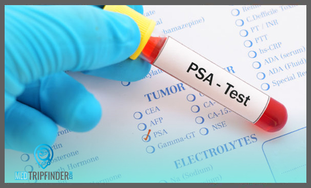 تحليل-PSA-للكشف-عن-أورام-البروستاتا تحليل-PSA-للكشف-عن-أورام-البروستاتا