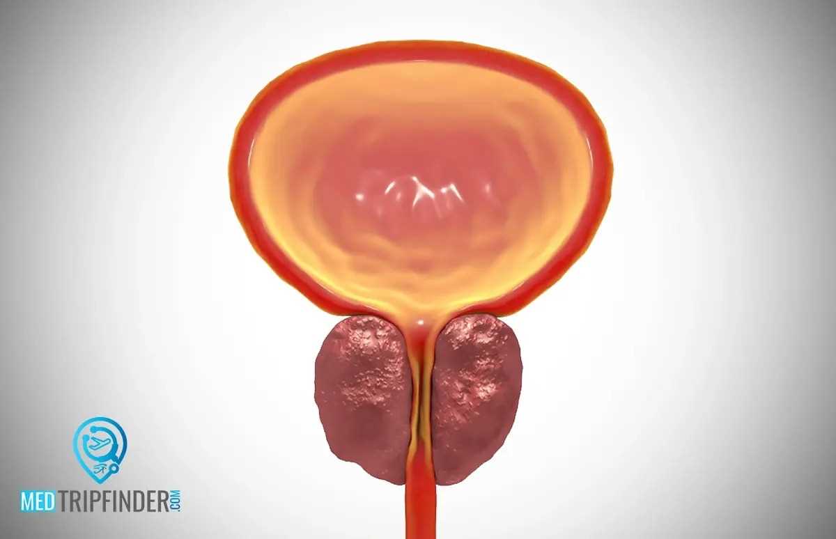 تضخم-البروستاتا تضخم-البروستاتا
